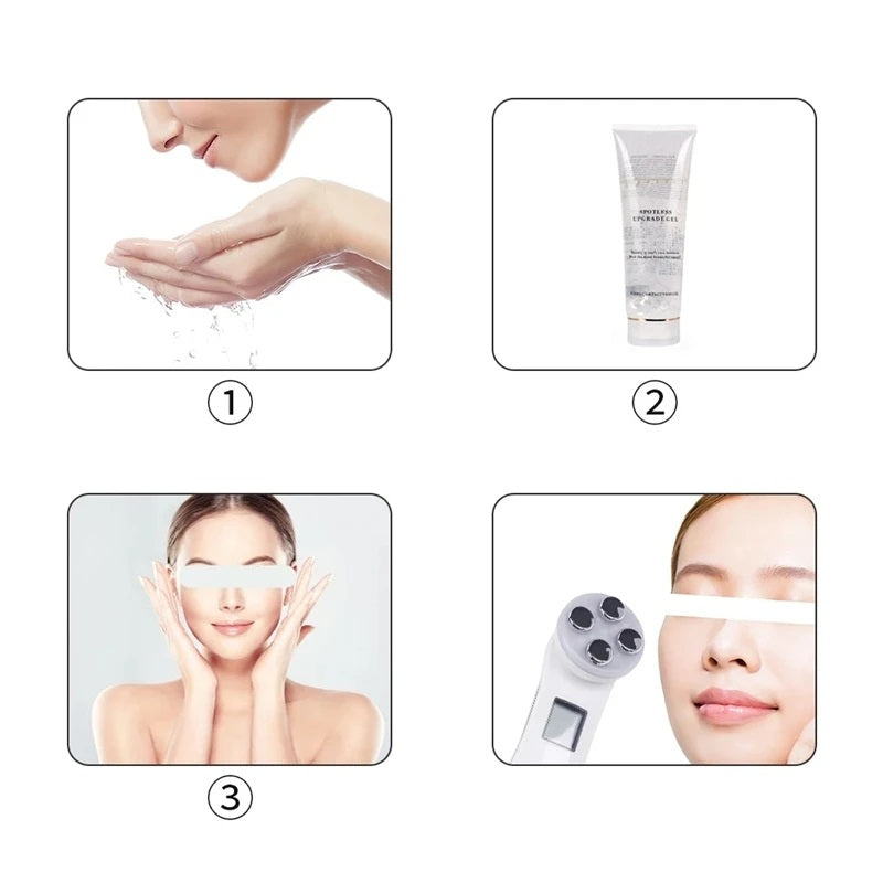 -20% RF-Gesichtsmassagegerät RF-Gesichtsmassagegerät LuminaBeauty   