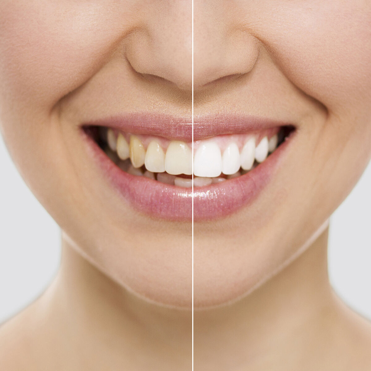 Whitening Strips Gesundheit und Körperpflege, Mundpflege InnovaGoods   